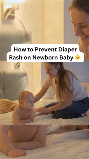 29K views · 153 reactions | Preventing diaper rash on your newborn...