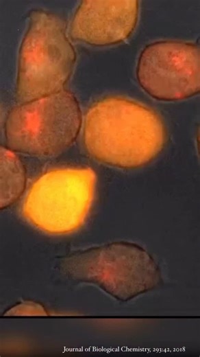 Biolab_divulga on Instagram: "🧬 Cellule NK vs Cellule Tumorali: immunologia in azione. Nel microambiente tissutale, le cellule Natural Killer (NK) svolgono un ruolo cruciale nella sorveglianza immunitaria.Sono capaci di riconoscere e distruggere cellule tumorali o infette senza bisogno di presentazione antigenica tramite MHC. 🔬 In questa immagine, vediamo una cellula NK che interagisce con cellule cancerose.Un confronto silenzioso ma letale, mediato da recettori attivatori e inibitori che valu
