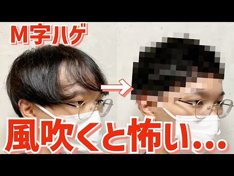 [Thinning Hair] Professional haircutting techniques to solve the problem of M-shaped baldness!
