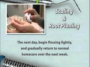 Scaling & Root Planing Post Op Instruction. www.kmperio.co.uk