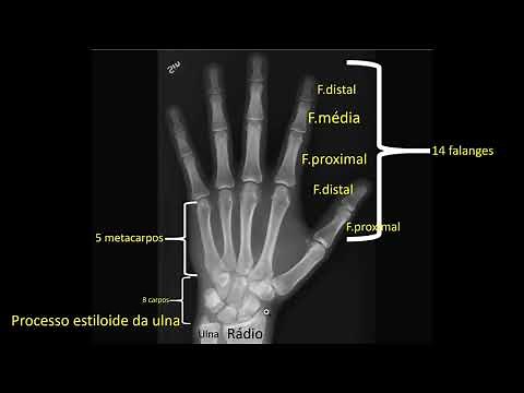 Radiologia - Anatomia radiográfica da mão e punho