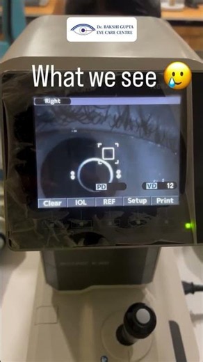 This Simple Eye Test Reveals More Than You Think