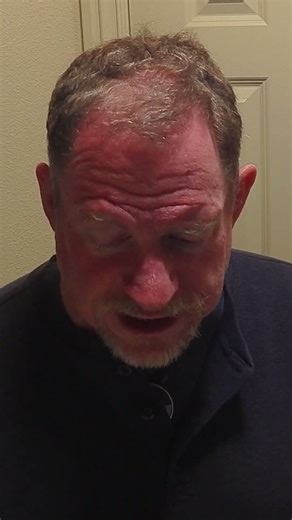 Benefits of TRT (Testosterone Replacement Therapy)