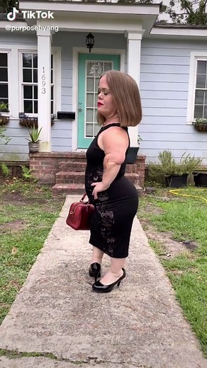 Gala Ready #dwarfmodel #aaf #americanadvertisingfederation #boardgala #dwarfism #selflove #beautyateverysize