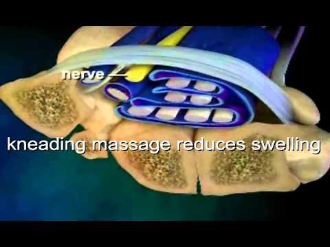 Myofascial Release Massage Therapy for Carpal Tunnel
