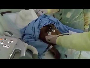 U/S assessment of the diaphragm live [ diaphragm protocol]