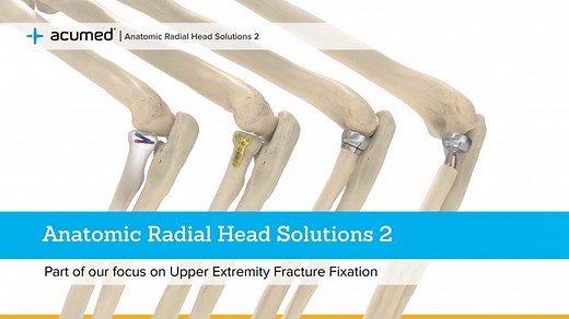 Anatomic Radial Head Solutions 2 System Overview