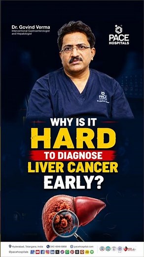 Why is Liver Cancer Hard to Diagnose Early? The Real Reason Liver Cancer is a "Silent Killer"