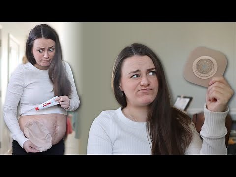 Maximizing Your Ostomy Bag's Life | Let's Talk IBD