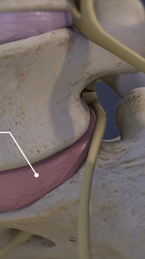 23K views · 184 reactions | Use this video to learn all about spinal conditions at the L5-S1 segment 領—from herniated discs and sciatica to degenerative disc disease and spinal stenosis. Discover common symptoms, causes, and treatment options so you can take steps toward pain relief and better spine health . | Spine-health | Facebook