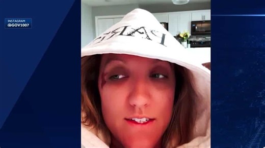 US Olympic volleyball player injured in Paris car crash after Olympics