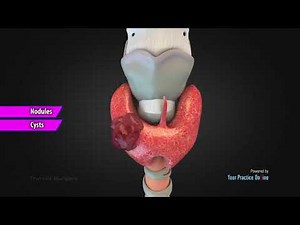 Thyroid Surgery