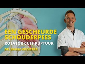 Gescheurde schouderpees (rotator cuff ruptuur)