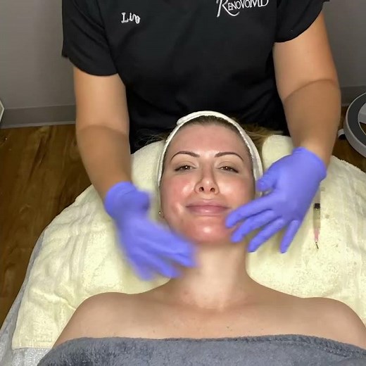 PRX T33 Facial Peel - RenovoMD