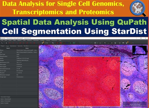 Spatial Data Analysis Using QuPath: Cell Segmentation Using StarDist in QuPath