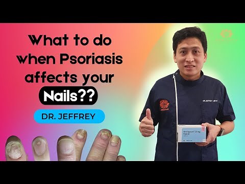 Final EP | Nail Psoriasis | What should you do? | Gorgeous Clinic | Dr. Jeffery | Dr. Chiam | 2021