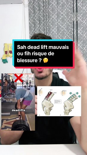 Risque de blessure lié au deadlift : Explications d'un kiné de sport