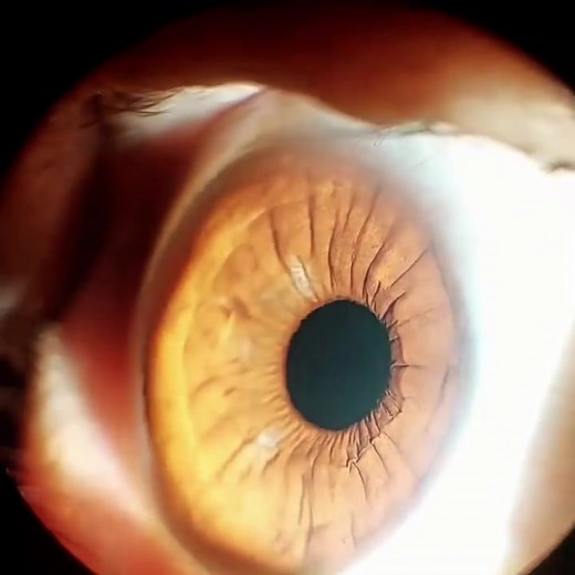 Understanding Eye Diagnoses: Insights from Ophthalmology