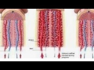 What is priapism ? Types causes
