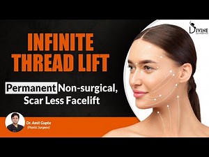 INFINITE THREAD LIFT: Permanent Non-surgical, Scarless Face Lift | Divine Aesthetic