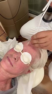 Cryotherapy for skin cancer ♋ And skin rejuvenation  What is cryotherapy? Cryotherapy uses liquid nitrogen to freeze and destroy cancer cells. It is commonly used to treat actinic keratoses. Also is very good choice for skin rejuvenation.  Stimulate the production of elastin and collagen Tighten pores & even skin tone Call us at. 22871110 #stimulate#Elasticity #collagen #skinfresh #skinpossitive #skincancer #skincancerawarenessmonth #cryosurgery | DC Dermatologicum | Facebook