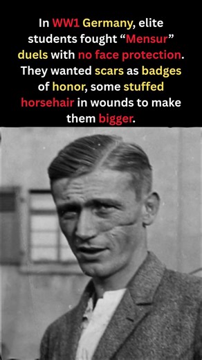 Germany’s WWI Face Scars #shorts