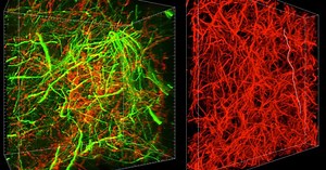 This new brain-scanning technique is literally mind expanding – Lifeboat News: The Blog