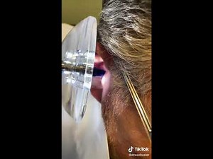 Ear Cleanings with "Dr. Wax Buster"