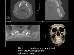 DVR Module Reference