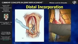 Extensor Mechanism Deficiency: A Synthetic Mesh Approach