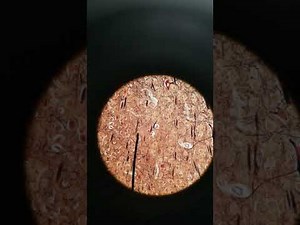 Pyramidal and purkinje cells histology