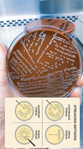 Abhay Mishra | Academic Advisor on Instagram: "🎖️Follow🧫✨ Mastering Streaking Methods in Microbiology! ✨🧫 From Quadrant to Continuous, from T-Streak to Radial, every method is a skill that helps isolate the tiniest life forms with precision. 🔬 Quadrant Streak 🧫 → “Classic method to isolate pure colonies step by step.” T-Streak ✍️ → “Quick and efficient way to separate bacteria in just three moves.” Continuous Streak 🔄 → “A smooth single motion across agar for dilution.” Radial Streak 🌟 →