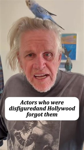 1.5K views · 16 reactions | Actors who were disfigured and Hollywood forgot them #actors #celebrities #hollywood #usa #foryou | Celebrities Orders | Facebook
