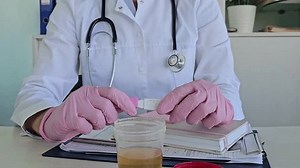 Artificial Model Kidney Ureter Human Standing Stock Footage Video (100% Royalty-free) 3628488617 | Shutterstock