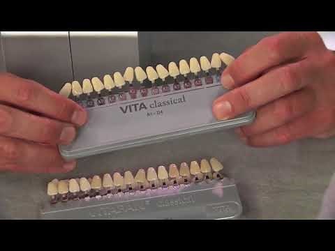 How to Use Vita Linearguide 3d Master Shade Guide