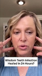 This is why cone beam CT scans are so important. On a regular X-ray, we couldn’t see anything. But the cone beam CT showed four unhealed wisdom tooth sites and an old infected root canal—quietly keeping her body in a constant inflammatory state. We treated the hidden infections, and the very next morning she felt better than she had in a decade. That’s what happens when the body finally gets relief. Areas where teeth were removed often don’t show up on 2D X-rays. Cone beam CT scans let us see wh