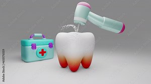 Tooth Decay Removal, Animation Video.1920 – 1080 Full HD Resolution
