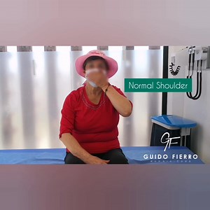 11 reactions · 34 shares | Hornblower sign: This sign assesses the...