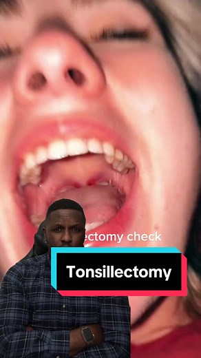 Understanding Tonsillectomy: Procedure, Recovery, and Benefits