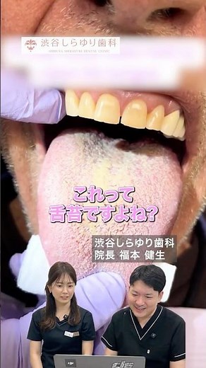 歯科医師が「舌苔」について解説✨