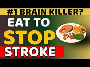Top 5 Natural Stroke-Preventing Foods – Even Doctors Recommend These!