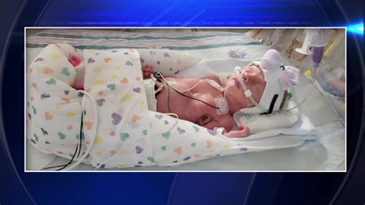 Woman gives birth to 1st quadruplets delivered at HCA Florida Mercy Hospital - WSVN 7News | Miami News, Weather, Sports | Fort Lauderdale
