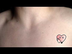 #012 Visible neck pulse after short exercise