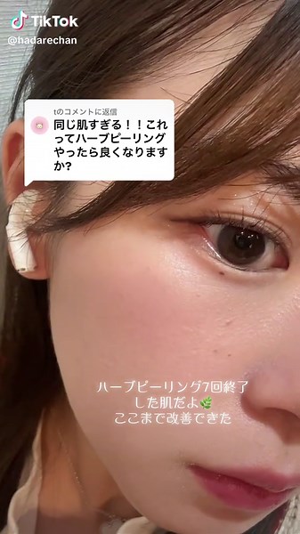 ハーブピーリングの効果とおすすめスキンケア方法