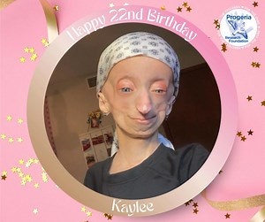 🎁 Kaylee from Ohio turns 22 today! 🎉 Happy Birthday to you Kaylee! It’s been an exciting year for Kaylee! In March, she was honored with the 2025 Milestones Award for Sciences by the YWCA of Northwest Ohio in recognition of her outstanding advocacy for Progeria Research. Kaylee is also taking part in PRF’s new progerinin clinical trial and is currently pursuing a degree in psychology with hopes of becoming a guidance counselor. #Progeria #happybirthday | Progeria Research Foundation