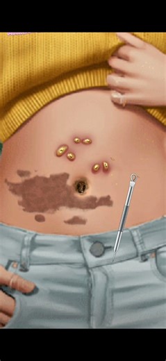 4K ASMR Belly Button Deep Cleaning & Satisfying Treatment #animation