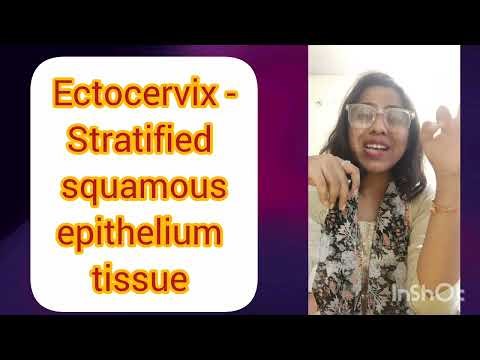 “Nabothian Cyst #NabothianCyst#CervicalCyst#CervixHealth#Gynecology