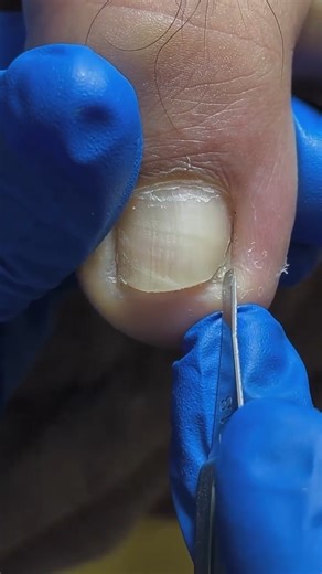 Pedicure Knife | Nail Salon