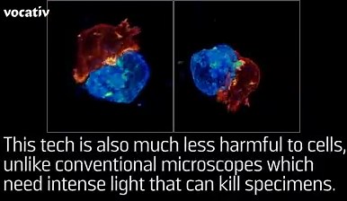 1.2K views · 7.3K shares | A new microscope reveals the fascinating...