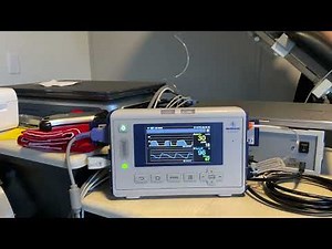 End-Tidal CO2 capnography in a tilt test